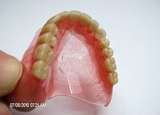 protezy zębowe Lublin